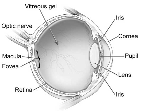 Retinal Detachment Diagram